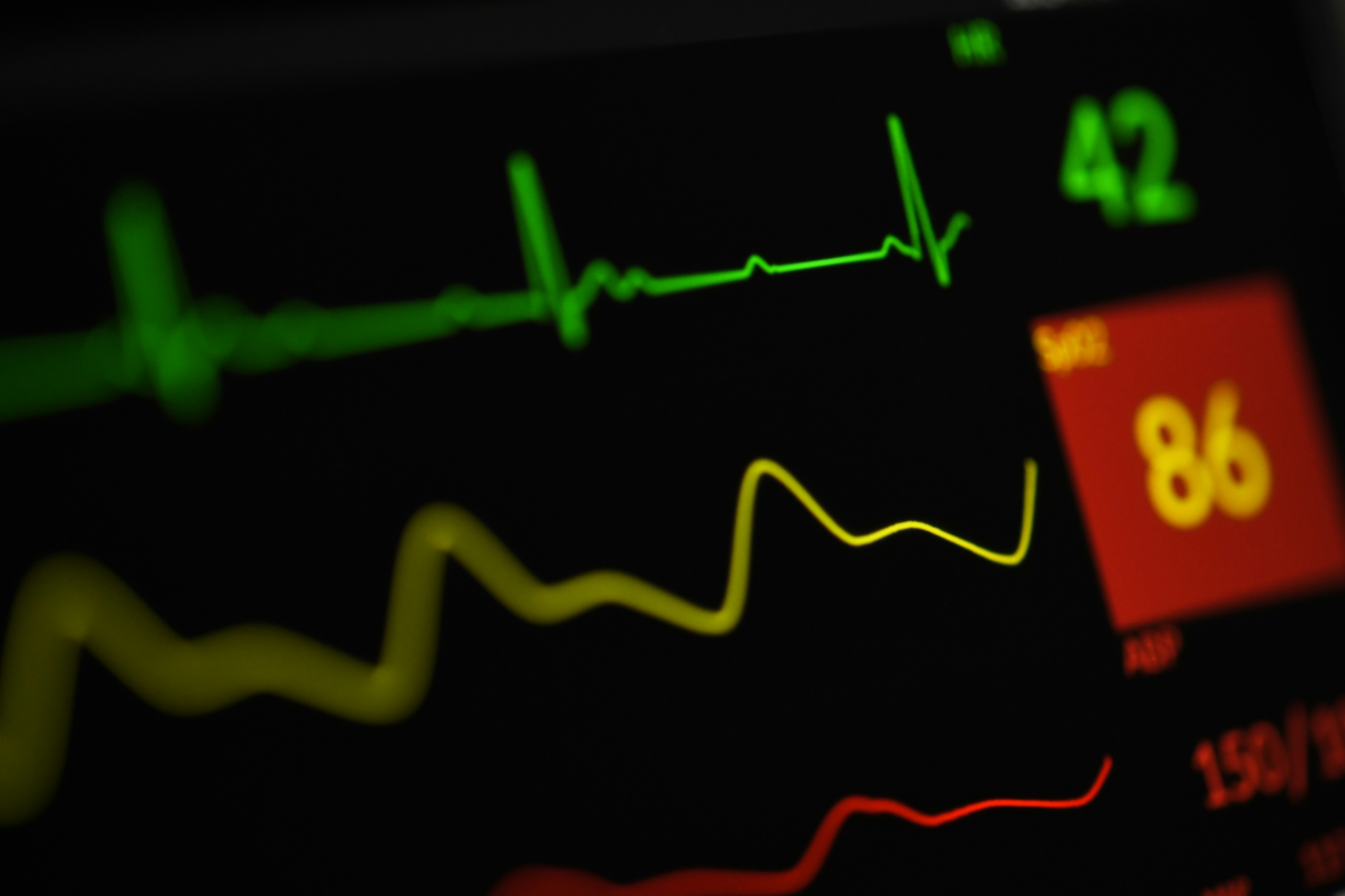 Alarms Raised by Critical Reverse Backdoor Vulnerability in Medical Devices